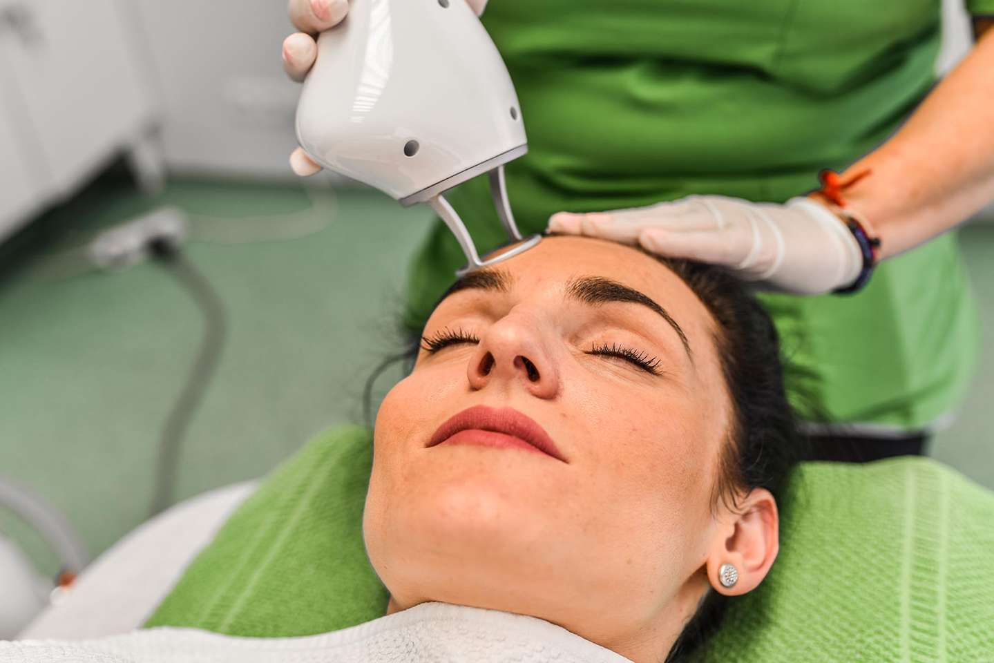 Frakčný resurfacing CO2 - účinné omladenie pokožky v medicínskom centre Crystal Esthetic Clinic
