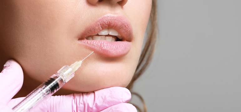 Russian lips alebo odstránenie vrások kyselinou hyalurónovou