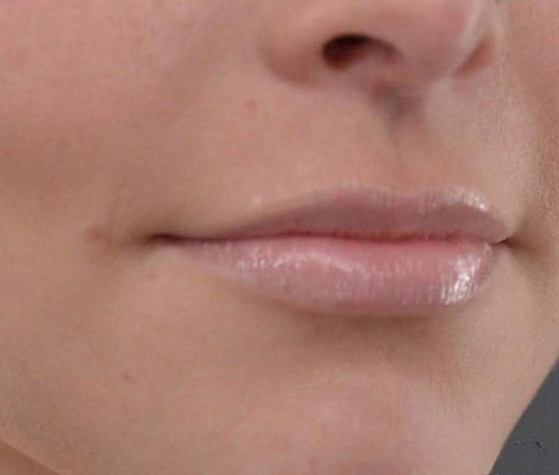 Po, Klinika Russian Lips 