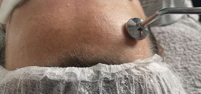 Hĺbkové čistenie pleti v salónie Monnie v centre Popradu
