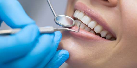Profesionálna dentálna hygiena, bielenie zubov a ozónoterapia v 24 DENTAL - zubná pohotovosť III.veže/Bratislava - Nové mesto