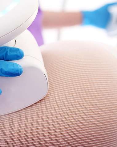 Schudnite bezbolestne s prémiovou liposukciou Ulthera SLIM