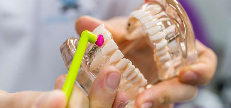 Profesionálna dentálna hygiena vo White Smile v Starom Meste