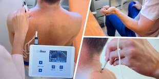 Elektroterapeutický prístroj Rebox v ŠNOPe