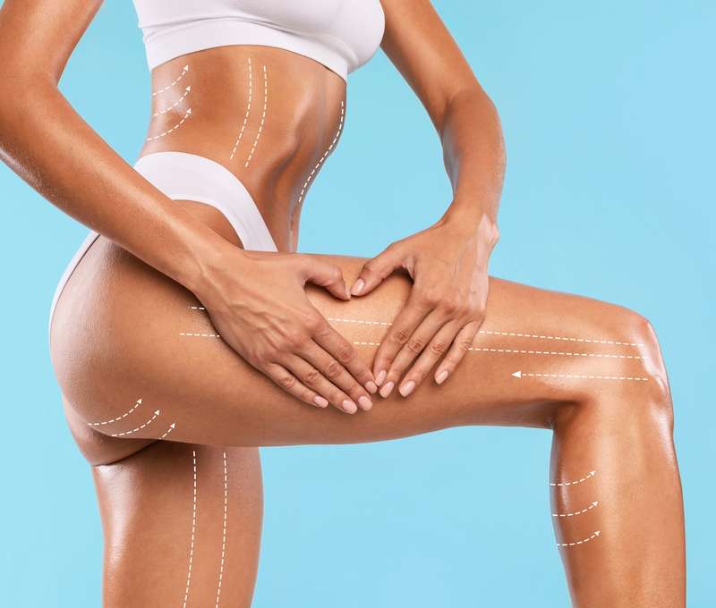 Tvarovanie svalov a redukcia tuku pomocou prístroja Body Sculpt