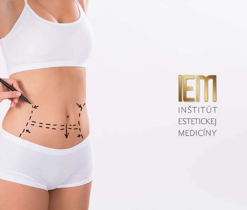 Plastická operácia ovisnutého podbruška v IEM- Miniabdominoplastika