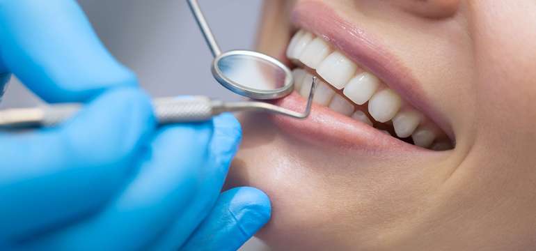 Dentálna hygiena vykonaná stomatológom