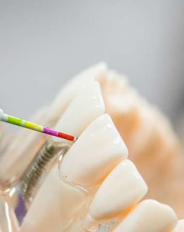 Profesionálna dentálna hygiena vo White Smile v Starom Meste