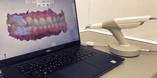 Novinka: 3D virtuálny model vašich zubov