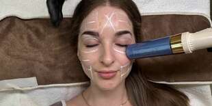 HIFU – revolučné spevnenie pleti a formovanie tela bez skalpela