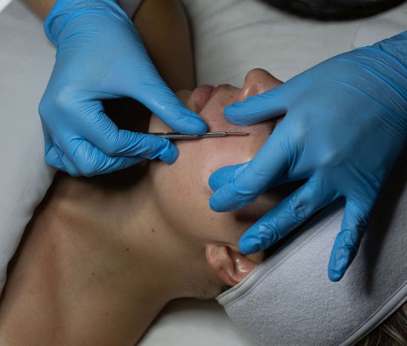 Dermaplaning - zamatovo hladká pleť bez ihiel