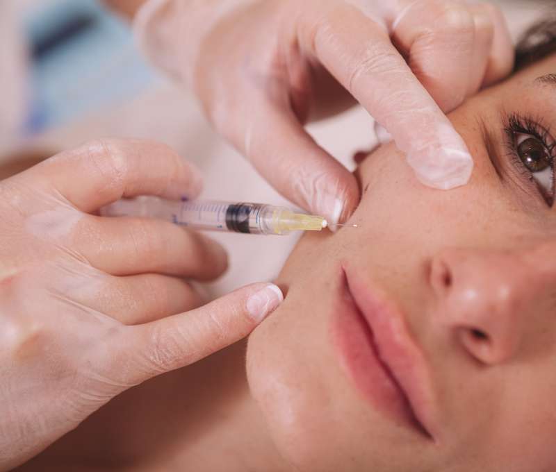 Prirodzené výplne kyselinou hyalurónovou | Bloom Clinic