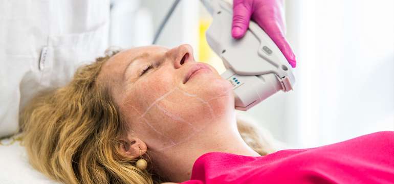 Neinvazívny facelifting Hifu SMAS ultherapia