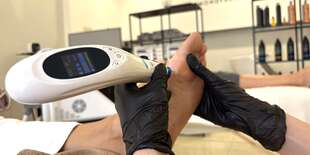 Odstránenie bradavíc, kurieho oka či výrastkov plazmovou technológiou