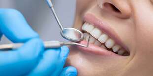 Dentálna hygiena alebo nová korunka