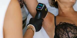 Laserová epilácia v Jardin de Beauté