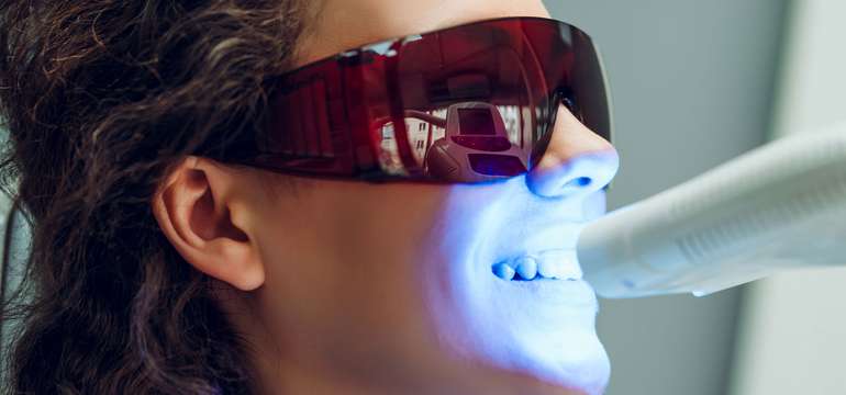 Dentálna hygiena alebo bielenie zubov