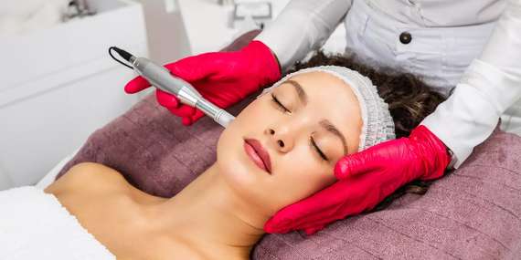Omladzujúca mezoterapia - microneedling s chemickým peelingom + navyše úprava a farbenie obočia/Bratislava - Krasňany