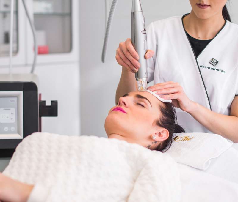Medicínska frakčná mikroihličková rádiofrekvencia