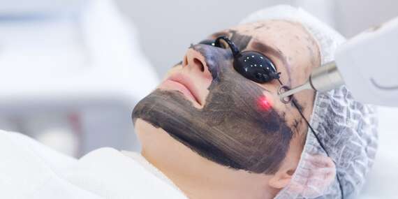 Hollywood carbon peel - revolučná liečba laserom s okamžite viditeľnými výsledkami/Prešov