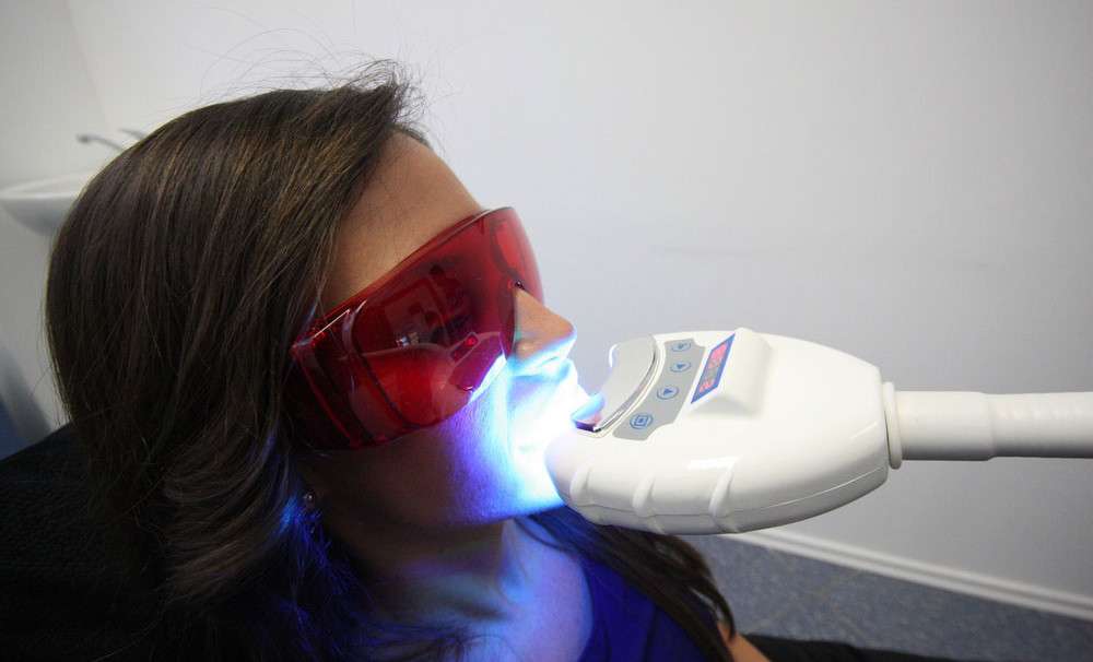 Bezpečné laserové bielenie zubov s nulovým obsahom peroxidu v salóne Brilliant Smile