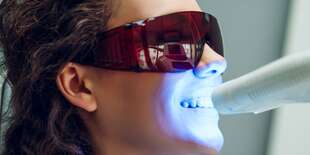 Dentálna hygiena alebo bielenie zubov