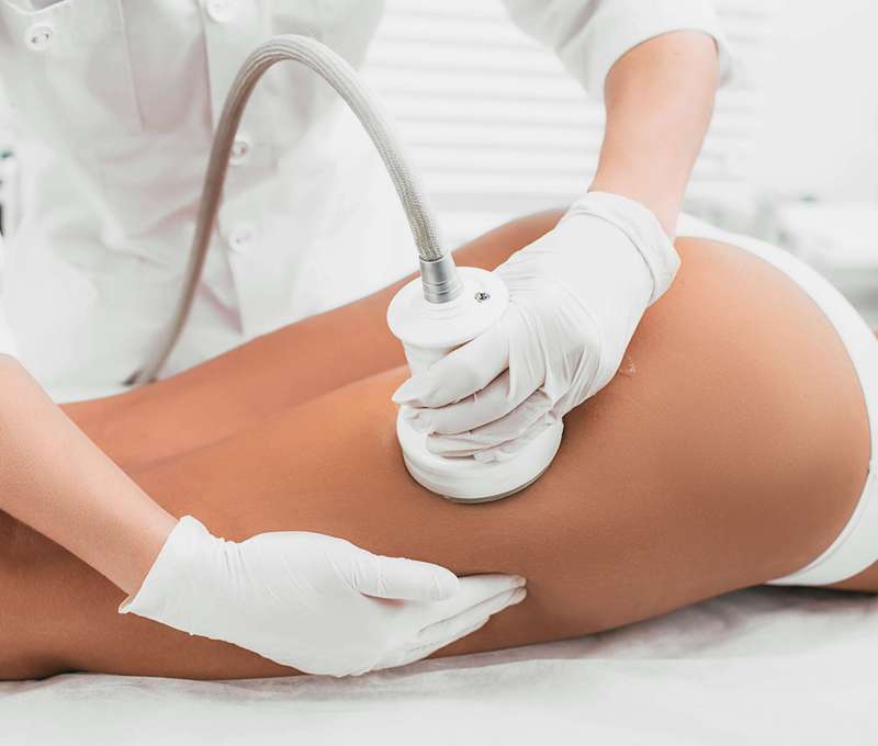 Ultrazvuková kavitácia alebo vákuová rádiofrekvenčná masáž