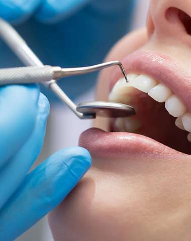 Dentálna hygiena v Martin Dental Clinic