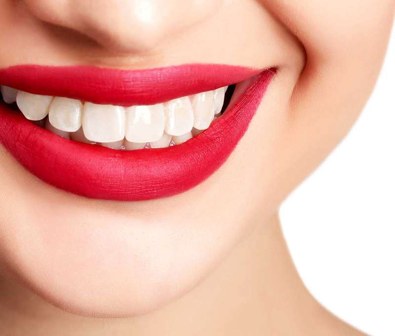 Dentálna hygiena a bielenie zubov pre žiarivý a zdravý úsmev