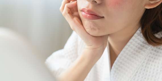 Dajte zbohom cievkam a pigmentáciám - objavte silu aparatívnej kozmetológie/Bratislava - Podunajské Biskupice