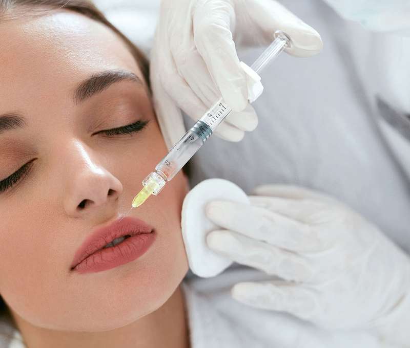 Aplikácia 1 ml kyseliny hyalurónovej 
