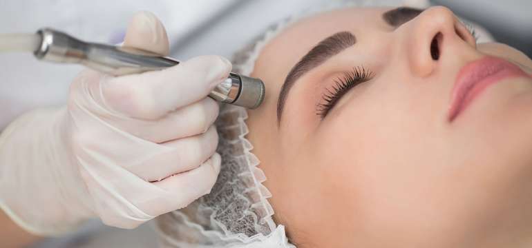 Diamantová dermabrázia  veľmi efektívna, účinná a bezpečná procedúra na omladenie  tváre