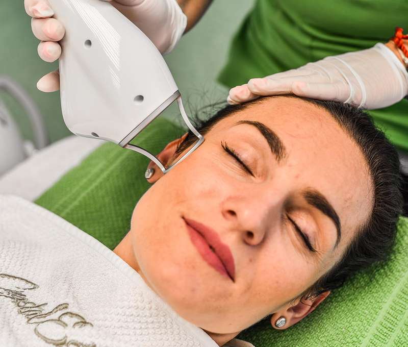 Frakčný resurfacing CO2 - účinné omladenie vašej pokožky v medicínskom centre Crystal Esthetic Clini